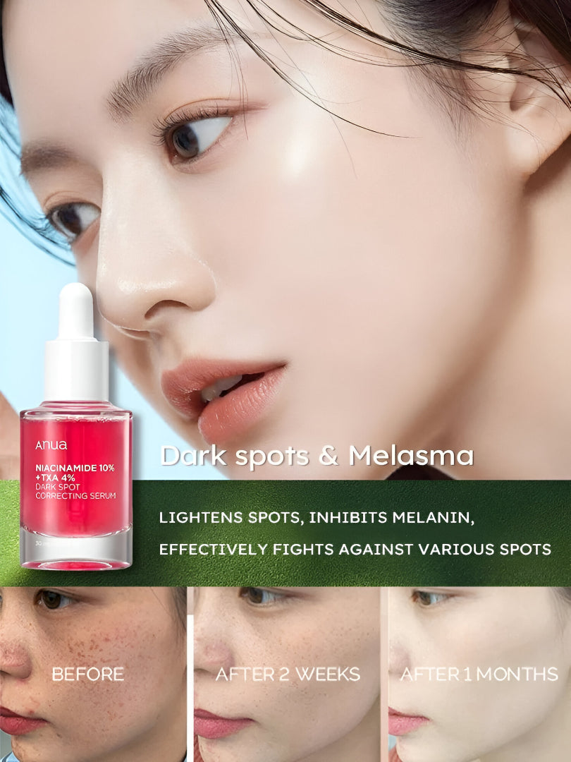 Anua Niacinamide 10% + TXA 4% Dark Spot Correcting Serum – Brightening & Even Skin Tone (30ml)