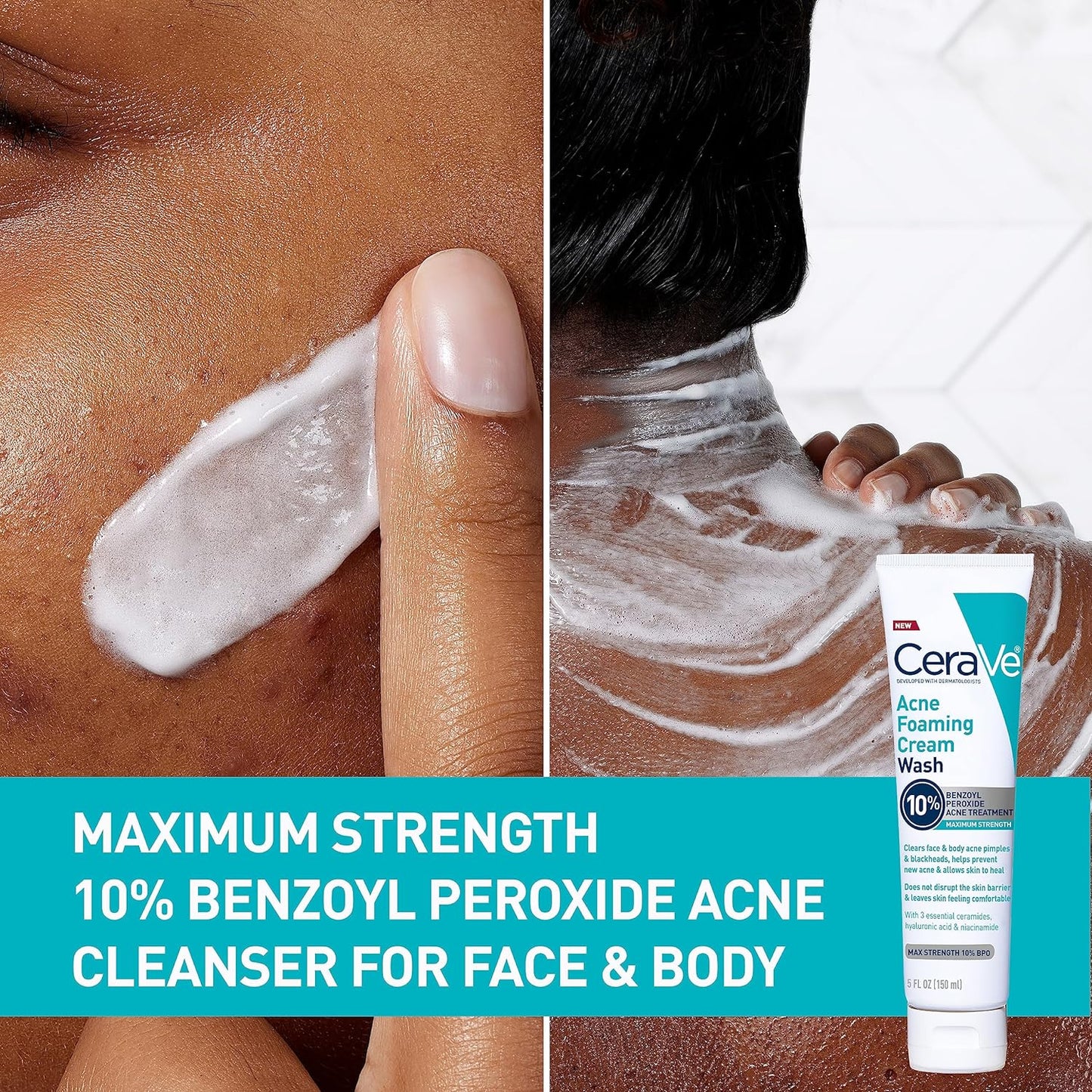 CeraVe Acne Foaming Cream Cleanser 150ml – 4% Benzoyl Peroxide Acne Treatment