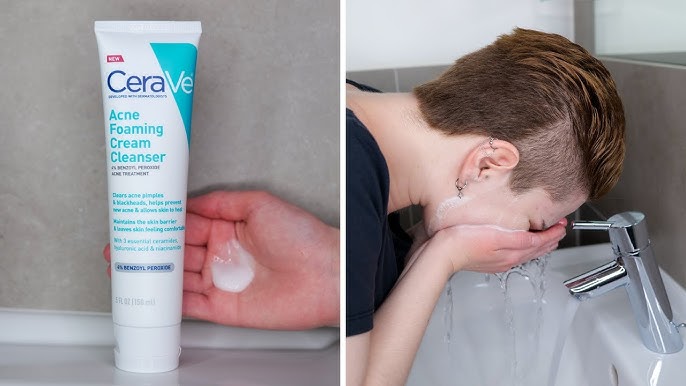 CeraVe Acne Foaming Cream Cleanser 150ml – 4% Benzoyl Peroxide Acne Treatment