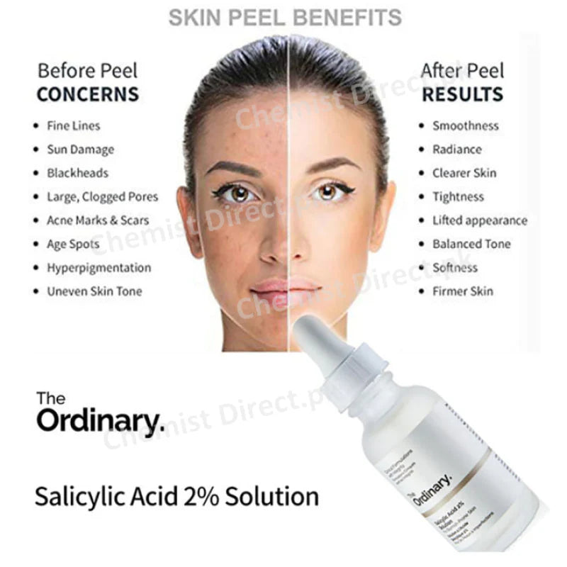 The Ordinary Salicylic Acid 2% Solution – Water-Based Blemish Control Serum