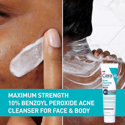 CeraVe Acne Foaming Cream Cleanser 150ml – 4% Benzoyl Peroxide Acne Treatment