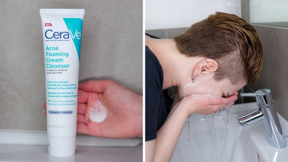 CeraVe Acne Foaming Cream Cleanser 150ml – 4% Benzoyl Peroxide Acne Treatment